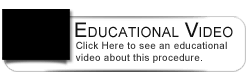 Dental Education Video - Invisalign FAQ's